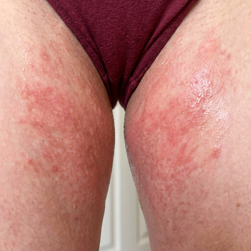 Inner Thighs